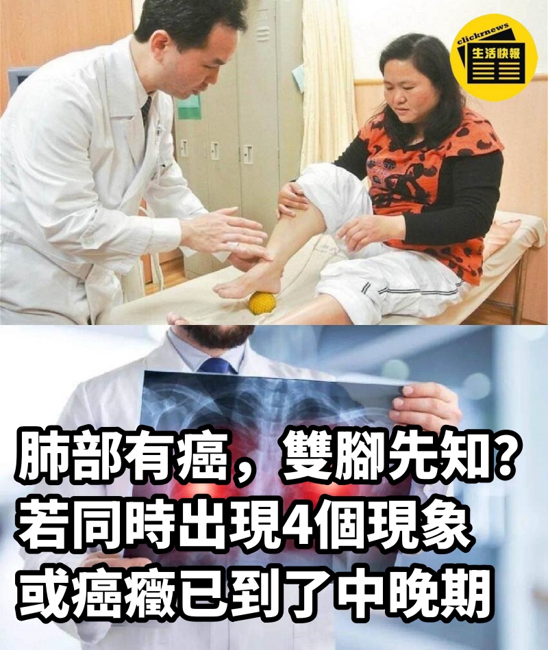 肺部有癌，雙腳先知？若同時出現4個現象，或癌癥已到了中晚期