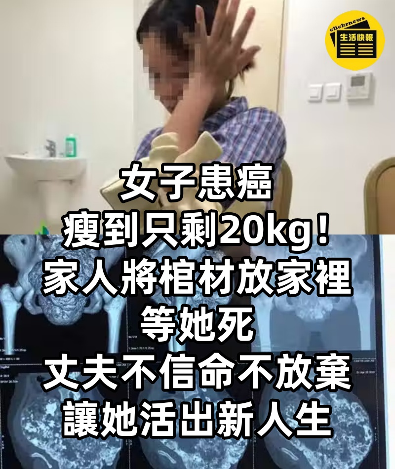 女子患癌瘦到只剩20kg！家人「將棺材放家裡」等她死　丈夫「不信命、不放棄」讓她活出新人生